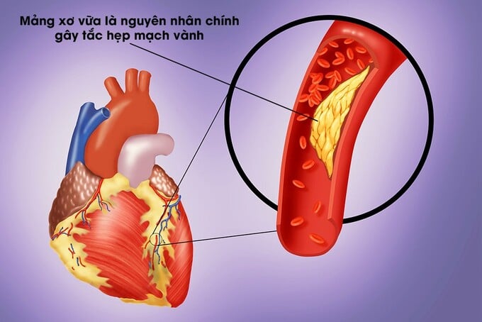 Ảnh minh họa (nguồn: Hội thần kinh học Việt Nam)