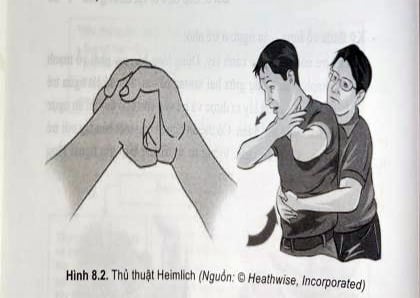 Thủ thuật heimlich ở trẻ lớn