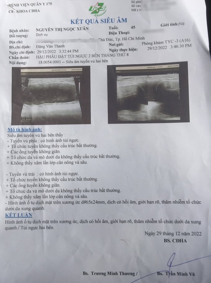 Kết quả siêu âm của bà Nguyễn Thị Ngọc Xuân tại Bệnh viện Quân y 175 cho kết luận: Hình ảnh ổ tụ dịch mặt trên xương ức, dịch có hồi âm, giới hạn rõ, thâm nhiễm tổ chức dưới da xung quanh/túi ngực hai bên