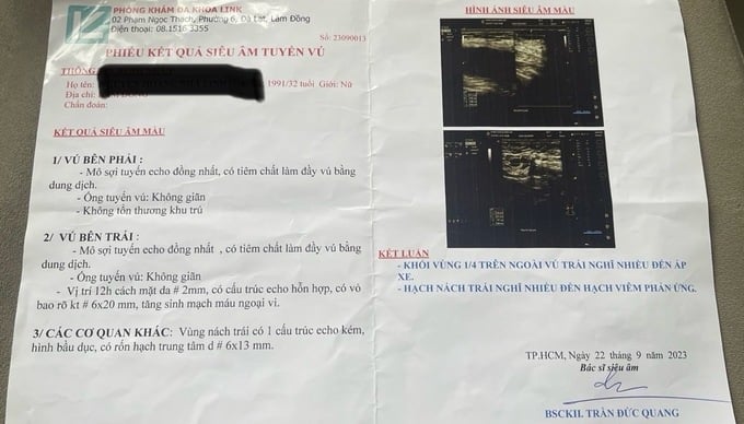 Phiếu kết quả siêu âm tuyến vú của chị L.
