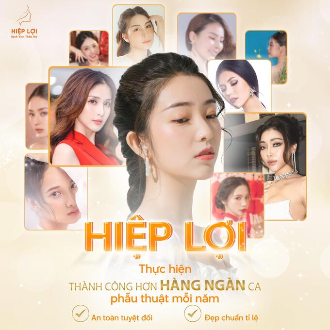 hình1