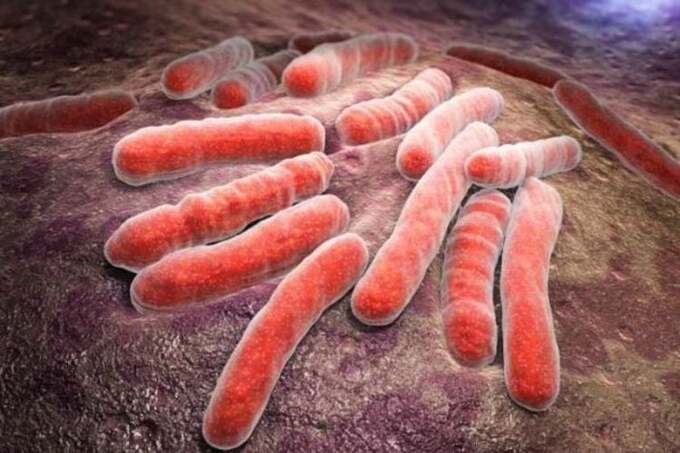 Vi khuẩn Mycobacterium tuberculosis gây bệnh lao