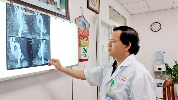 BS.CKII Thân Trọng Vũ - Trưởng khoa Ngoại lồng ngực, Bệnh viện Đà Nẵng xem xét trên phim chụp CT của bệnh nhân
