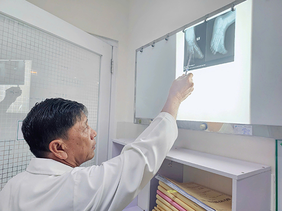Bệnh ngón chân cái phì đại bẩm sinh là một bệnh lý hiếm gặp và phức tạp (Ảnh minh họa)