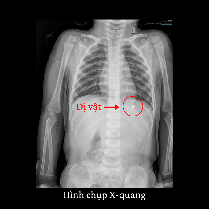 Be-trai-2-tuoi-nuot-tron-oc-vit-sac-nhon