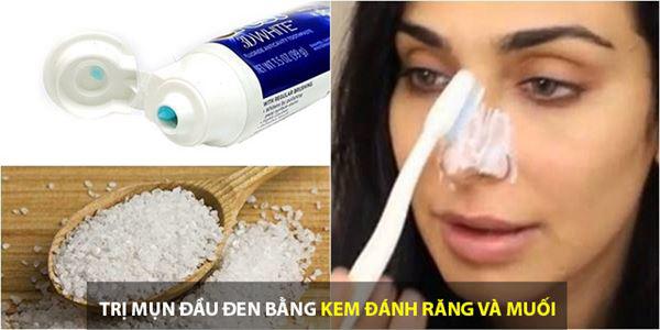 cach tri mun dau den tan goc tai nha nhanh va hieu qua nhat - 5