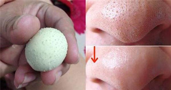 cach tri mun dau den tan goc tai nha nhanh va hieu qua nhat - 3