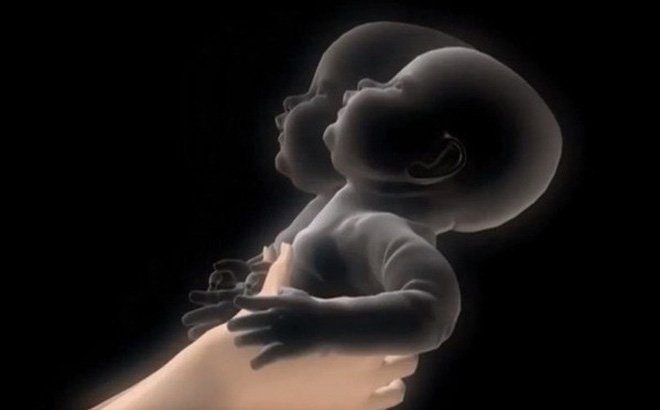 Hội chứng rung lắc ở trẻ em: Những điều cần biết | Vinmec
