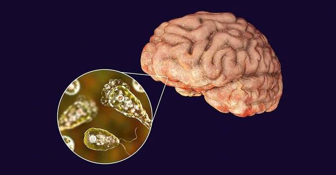 Amip ăn não người có tên khoa học là Naegleria Fowleri.