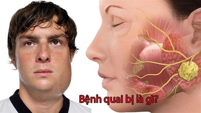 (Ảnh Internet)