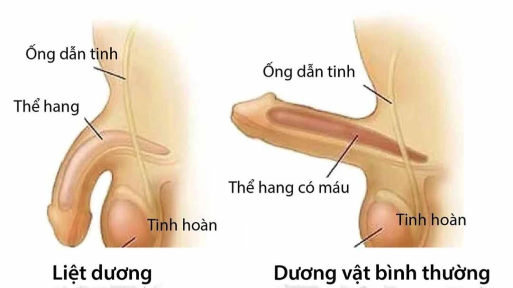 roi-loan-cuong-duong-16345715389132006860497
