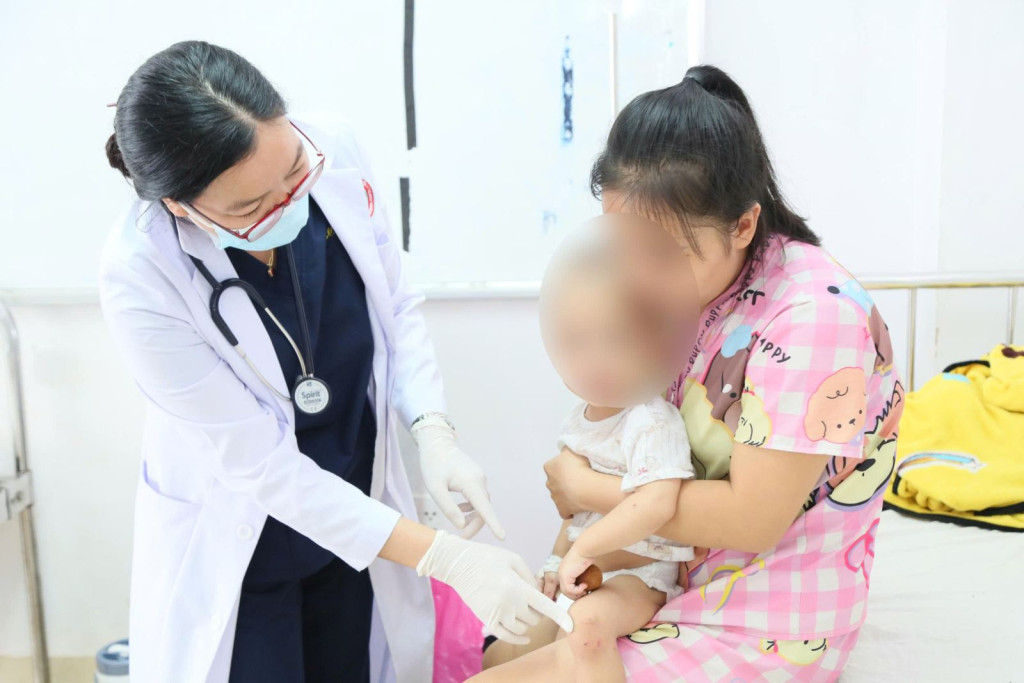 anh-21