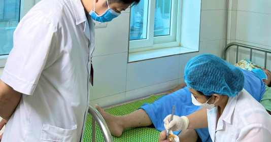 Bệnh nhân bị hoại tử, phải tháo bỏ ngón chân vì tự đắp thuốc kháng sinh