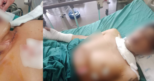 Dây diều thả trên cầu Thủ Thiêm 1 cứa rách cổ người đi đường