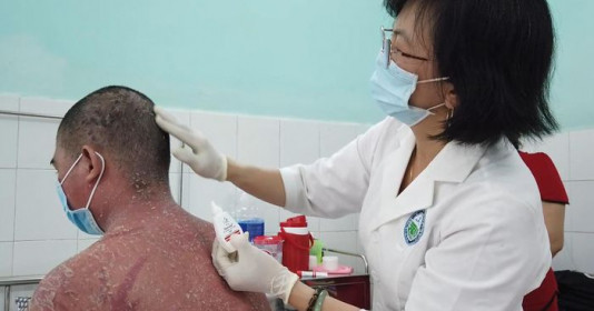 Quảng cáo thuốc điều trị khỏi hẳn bệnh vảy nến là sai sự thật