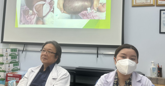 Bệnh viện Nhi đồng 1 phẫu thuật thành công khối u cổ, mặt cho bé trai sơ sinh