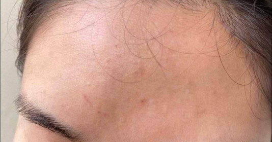 Nữ nhân viên y tế ở Đồng Tháp bị người nhà bệnh nhân hành hung