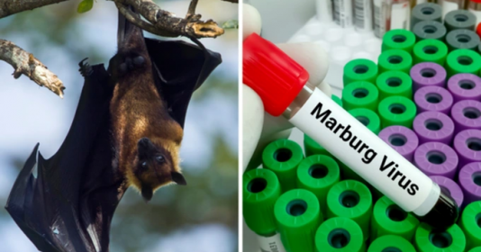 Virus Marburg nguy hiểm thế nào?