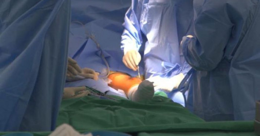 Vinmec thực hiện thành công ca phẫu thuật thay khớp tăng trưởng cho bệnh nhi 9 tuổi 