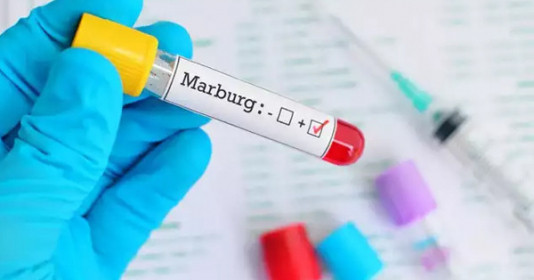 WHO: Thêm 5 người đã tử vong do nhiễm virus Marburg