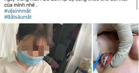 Cảnh giác với dịch vụ bắt sâu mắt trên mạng xã hội