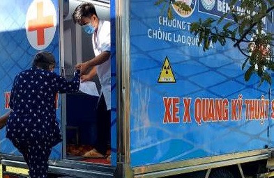 Chiếc lược 2X trong tầm soát Lao chủ động tại cộng đồng ở Đà Nẵng