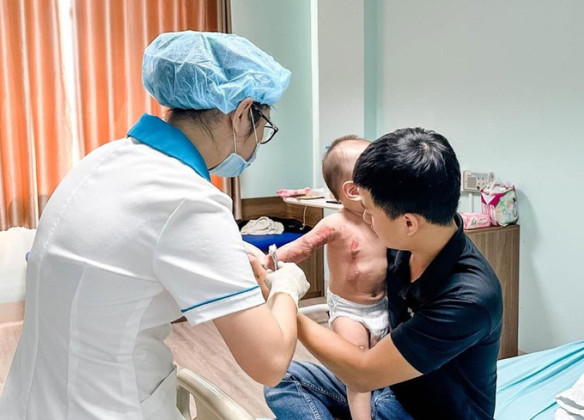 Đồng Nai: Điều trị cho bé 13 tháng tuổi bị bỏng nước sôi