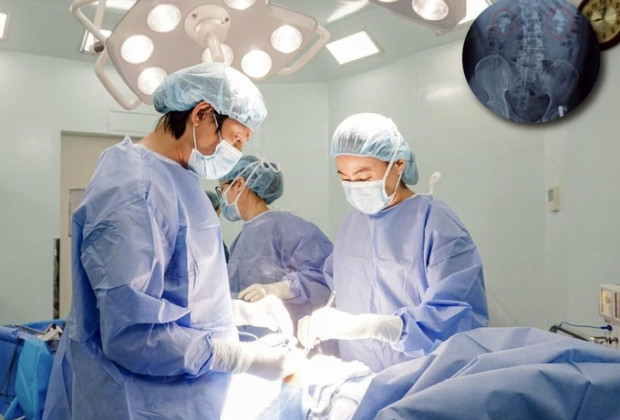 Đồng Nai: Phẫu thuật lấy sỏi thận phức tạp hai bên cho bệnh nhân