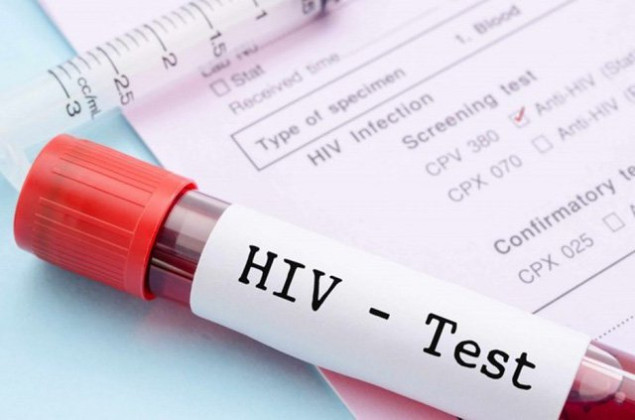 Lợi ích của việc xét nghiệm HIV sớm