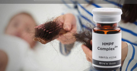 Liệu pháp HMPFComplex2m – Liệu pháp điều trị rụng tóc sau sinh