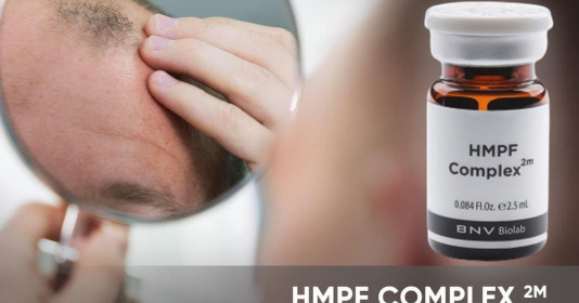Hói đầu di truyền có chữa được không?
