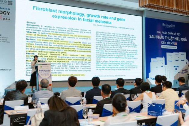 Vai trò tiên phong của G4PRF-300™  trong điều trị nám và tăng sắc tố sau viêm