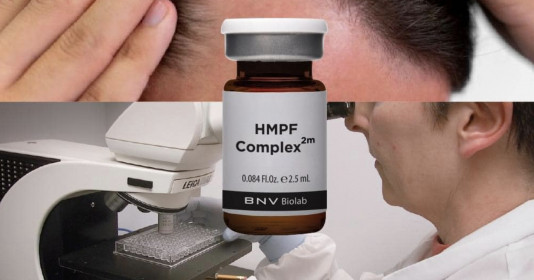 Phát hiện phức hợp tiên phong G4PRF-300™ xóa bỏ nỗi lo rụng tóc hói đầu chỉ trong 2 tháng