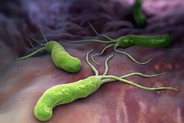 Các biện pháp phòng ngừa vi khuẩn HP (Helicobacter Pylori)