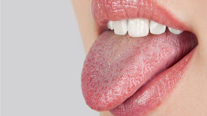 Các biện pháp khắc phục tại nhà cho chứng khô miệng