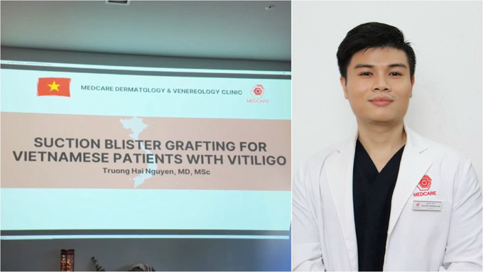 Bác sĩ Việt Nam tham gia báo cáo về bệnh Bách Biến tại hội nghị Quốc tế