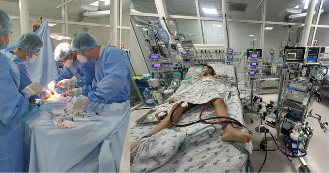TP. HCM: Cứu sống bé gái mắc viêm cơ tim tối cấp và sốc tim