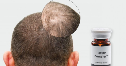 Xóa bỏ nỗi lo rụng tóc hói đầu ngay hôm nay