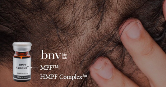 HMPF Complex 2m giải pháp phục hồi nang tóc độc quyền từ USA