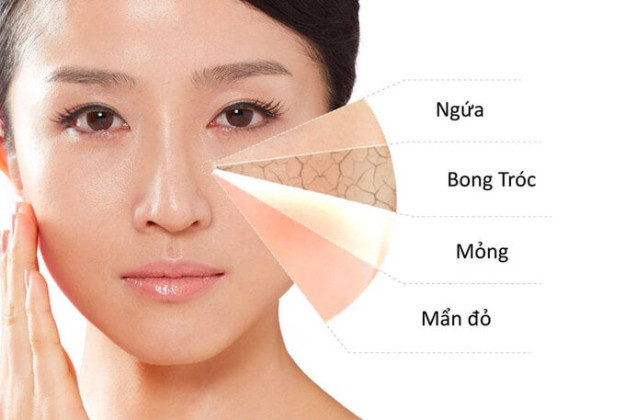 SMPF Complex 1M: Sử dụng công nghệ độc quyền MPF™ điều trị da nhạy cảm và viêm nhiễm