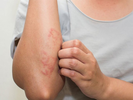 Cẩn thận bệnh do nhiễm ký sinh trùng nguy hiểm