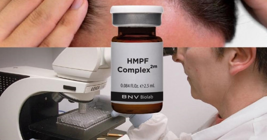 Lợi ích dài hạn của việc sử dụng HMPF Complex 2m cho tóc