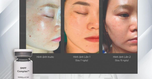 Công nghệ hiện đại MPF™ và ứng dụng trong lĩnh vực y học: Nâng cao sức khỏe tế bào