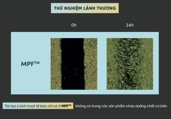 Khám phá cách công nghệ độc quyền MPF™ đến từ USA xoá mờ tàn nhang và cải thiện tông màu da