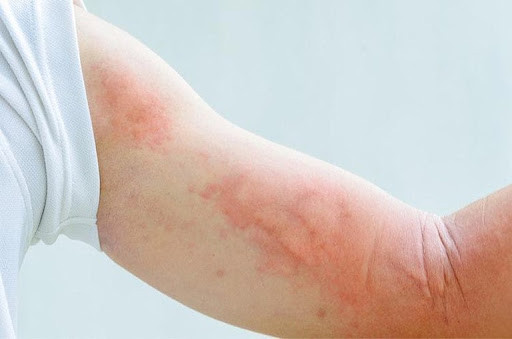 Xét nghiệm để phát hiện bệnh do nhiễm ký sinh trùng