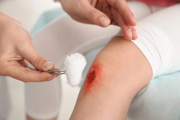 Sơ cứu vết thương chảy máu bên ngoài cơ thể