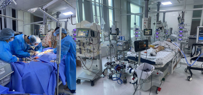 Can thiệp ECMO cứu sống bé gái viêm cơ tim tối cấp