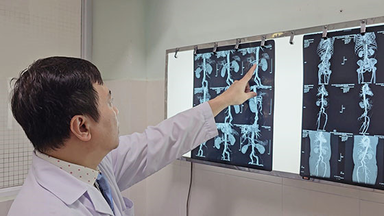 Điều trị thành công bệnh rất hiếm gặp: Bóc tách động mạch treo tràng trên đơn độc