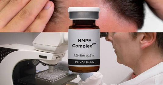 Mọc tóc trở lại sau thời gian đội tóc giả