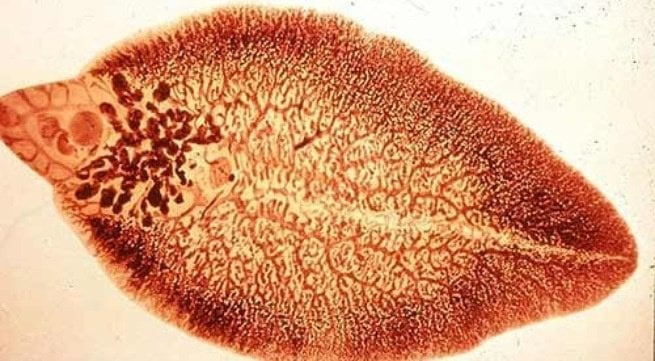 Nhận biết và phòng chống bệnh sán lá gan nhỏ: Clonorchiasis